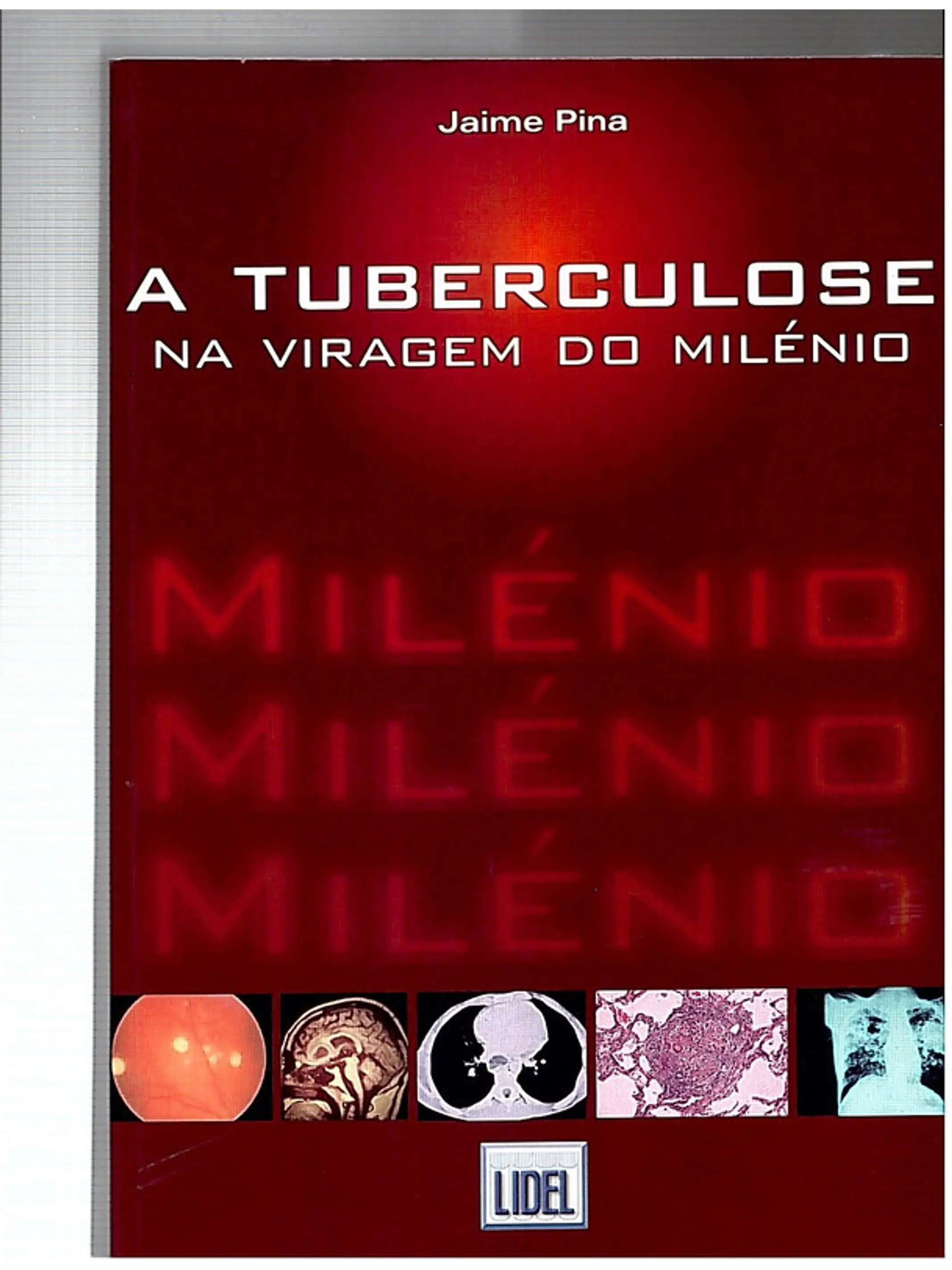 A tuberculose na viragem do milénio 1