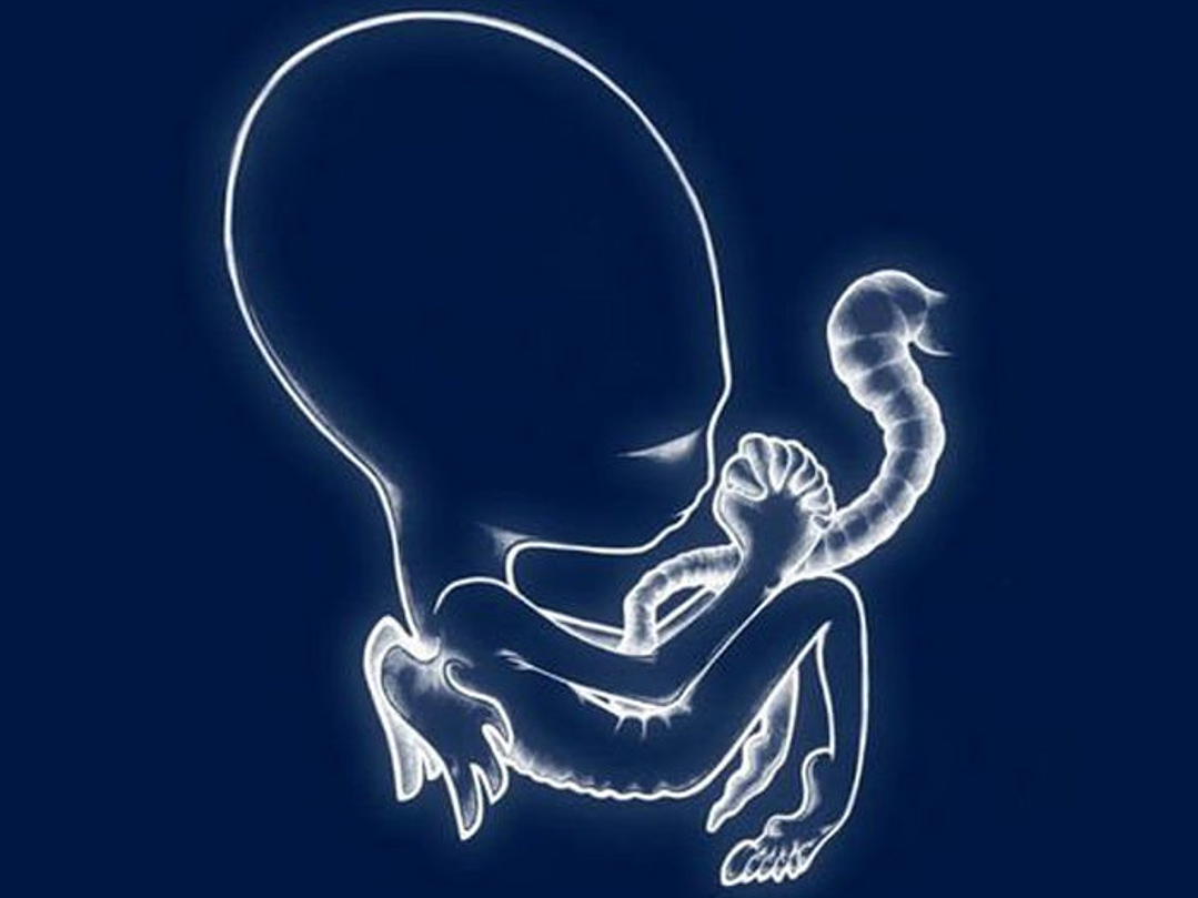 Sigur Rós - Ágaetis Byrjun 1