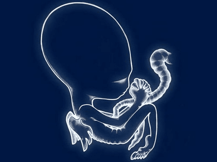 Sigur Rós - Ágaetis Byrjun 1