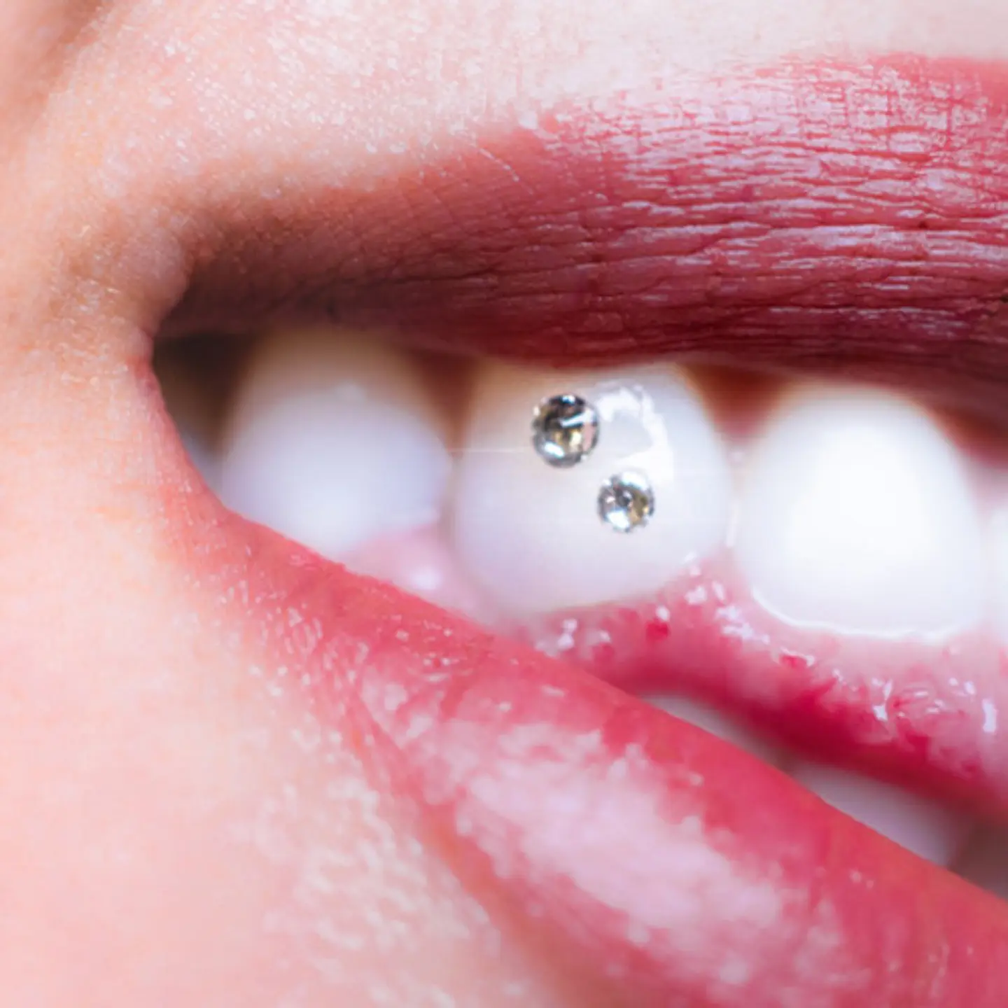 Piercing Dental Cristal Lapidado X 10 Unidades 1