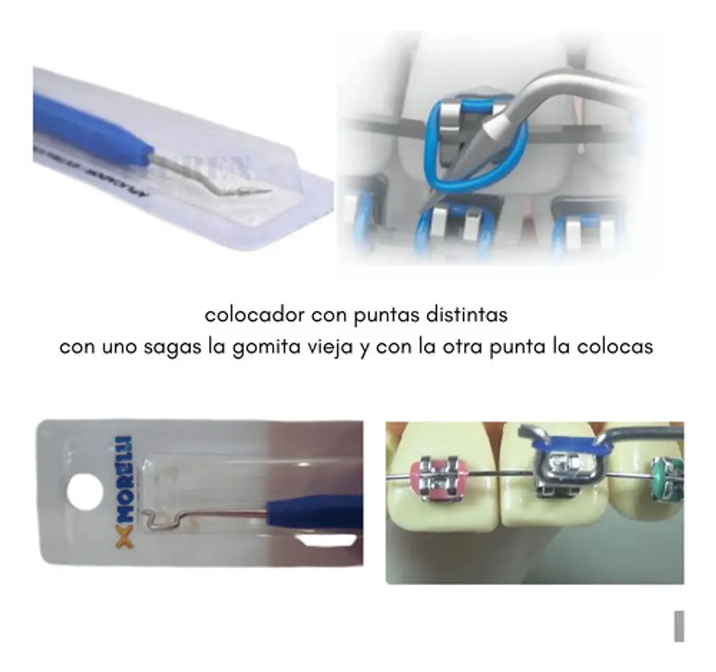 Aplicador + 1000 Gomitas Surtidas Para Brackets 2