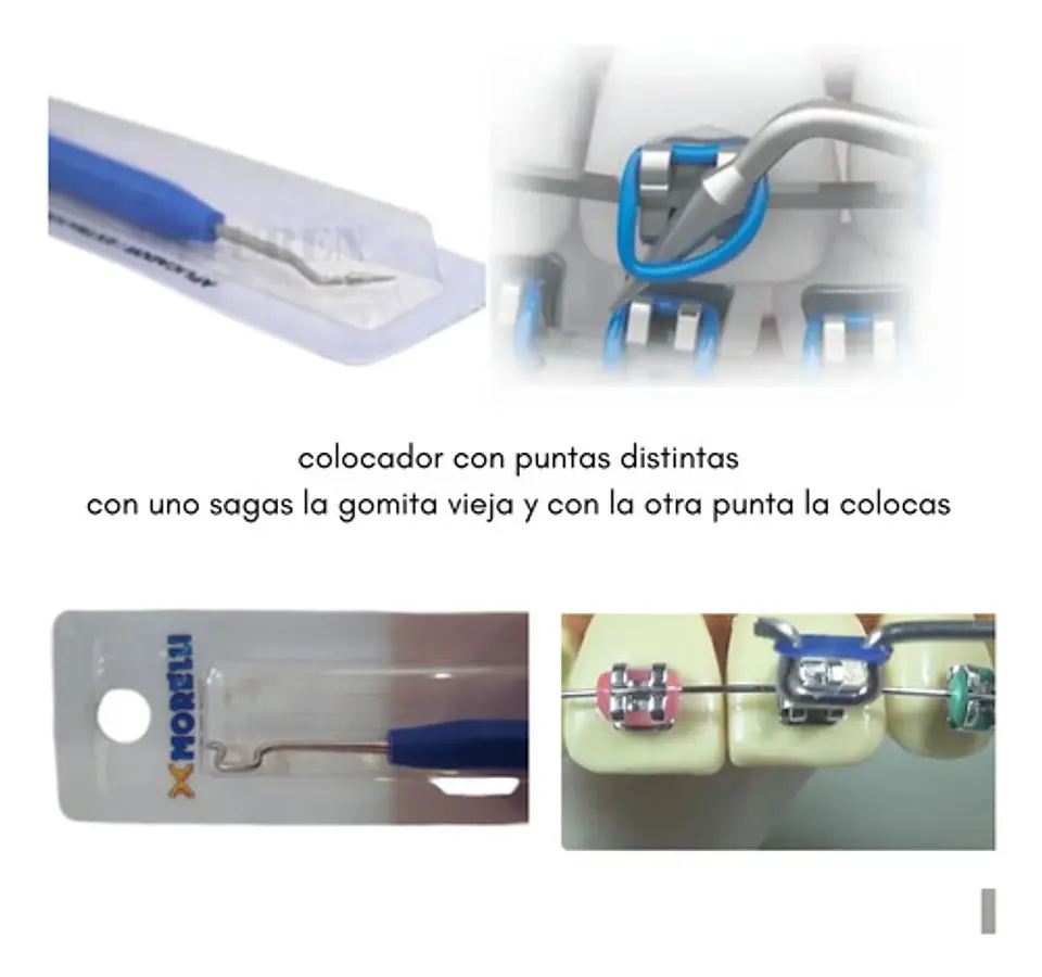 Aplicador + 1000 Gomitas Surtidas Para Brackets 2
