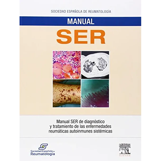 MANUAL SER DE DIAGNOSTICO Y TRATAMIENTO DE LAS ENFERMEDADES REUMATICAS AUTOINMUNES SISTEMICAS 