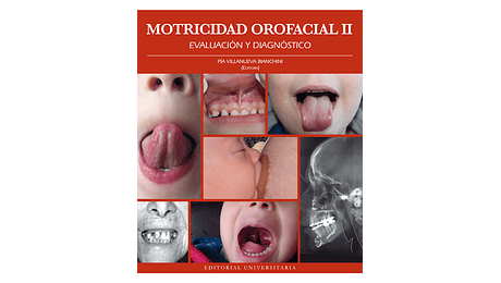 Motricidad Orofacial Tomo II: Evaluación y Diagnóstico