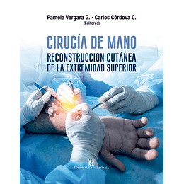 Cirugia De Mano