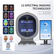 Analizador de Piel Facial 3D con AI