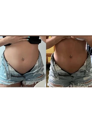 LIPOFITE Portugal®