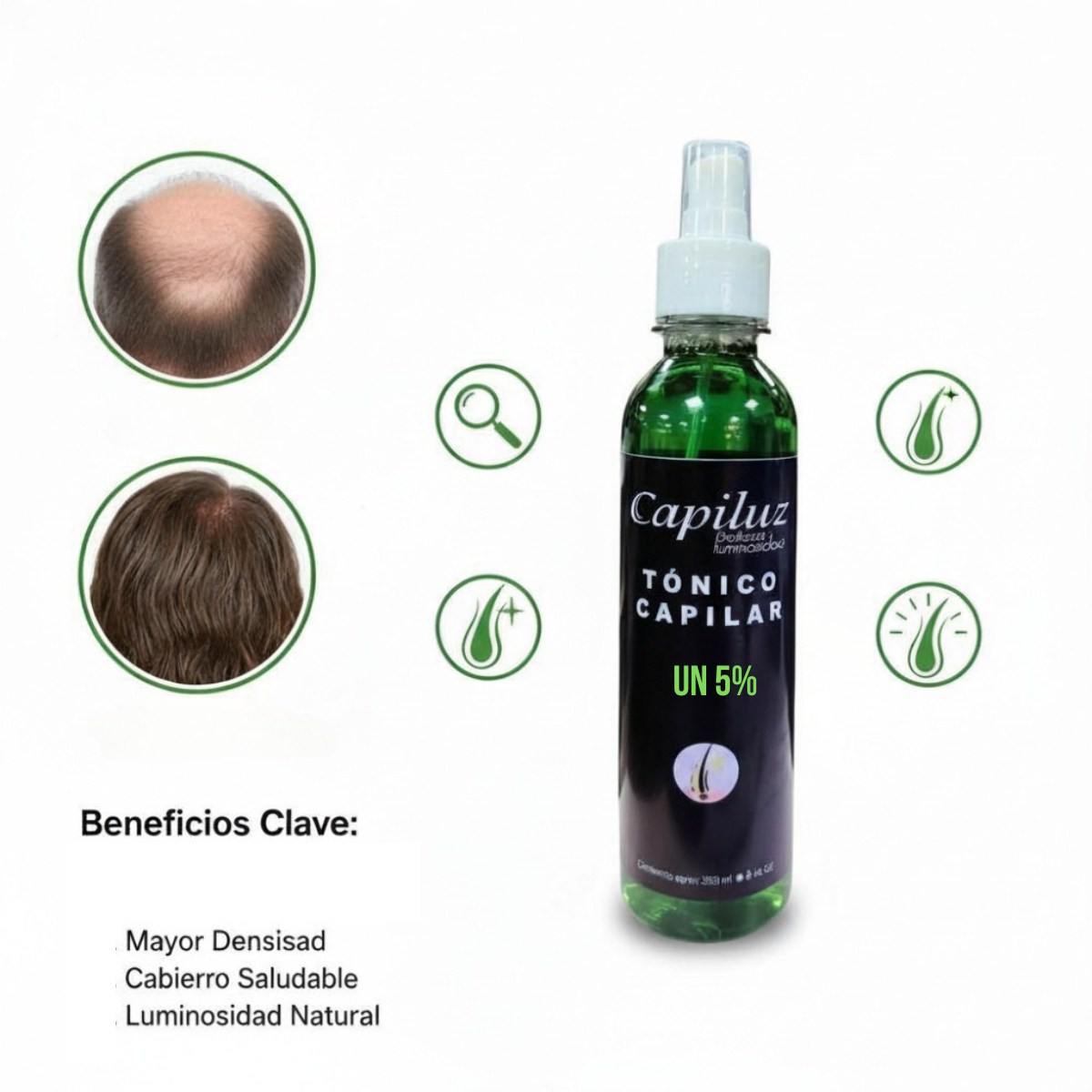 Loción Capilar 5% Densidad Y Engrosamiento Capiluz 2