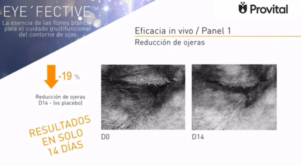 Crema Cosmo - Tratamiento liporellenador de arrugas. Huerta de Mamá