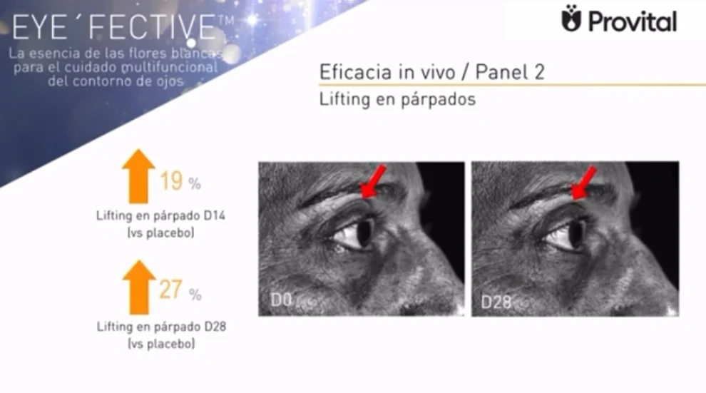 Crema Cosmo - Tratamiento liporellenador de arrugas. Huerta de Mamá