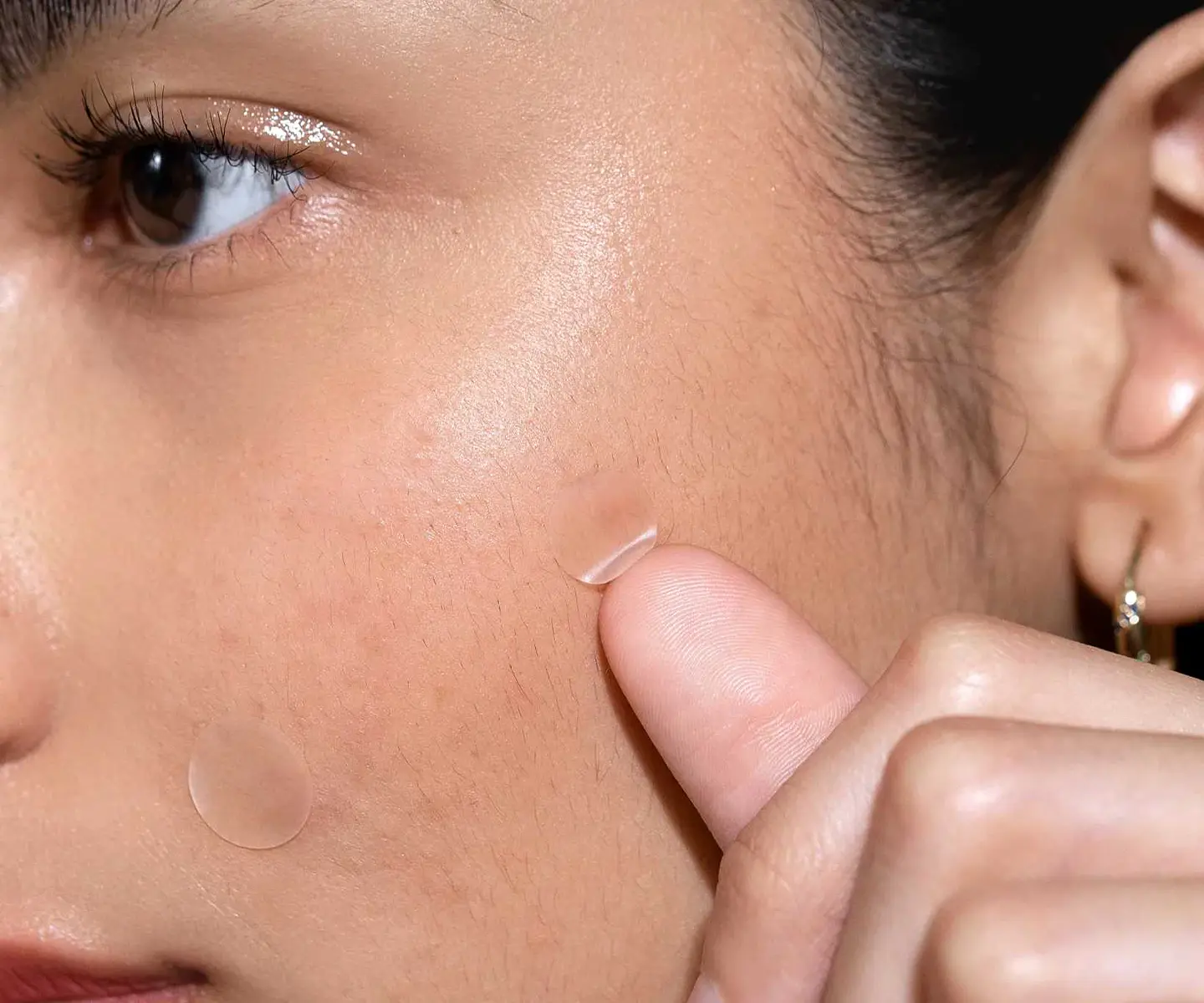 Pimple Hugger (Parches para brotes) 2