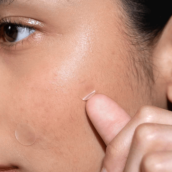 Pimple Hugger (Parches para brotes) 2