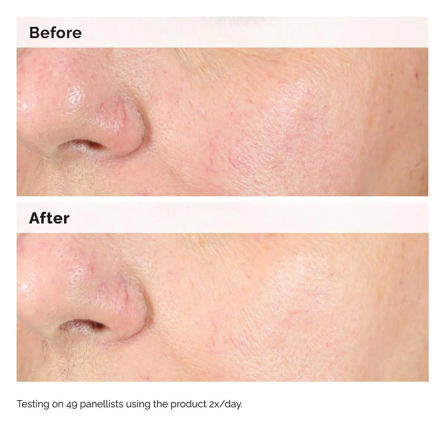 Alpha Arbutin 2% + Hyaluronic Acid for Hyperpigmentation 60ml 3