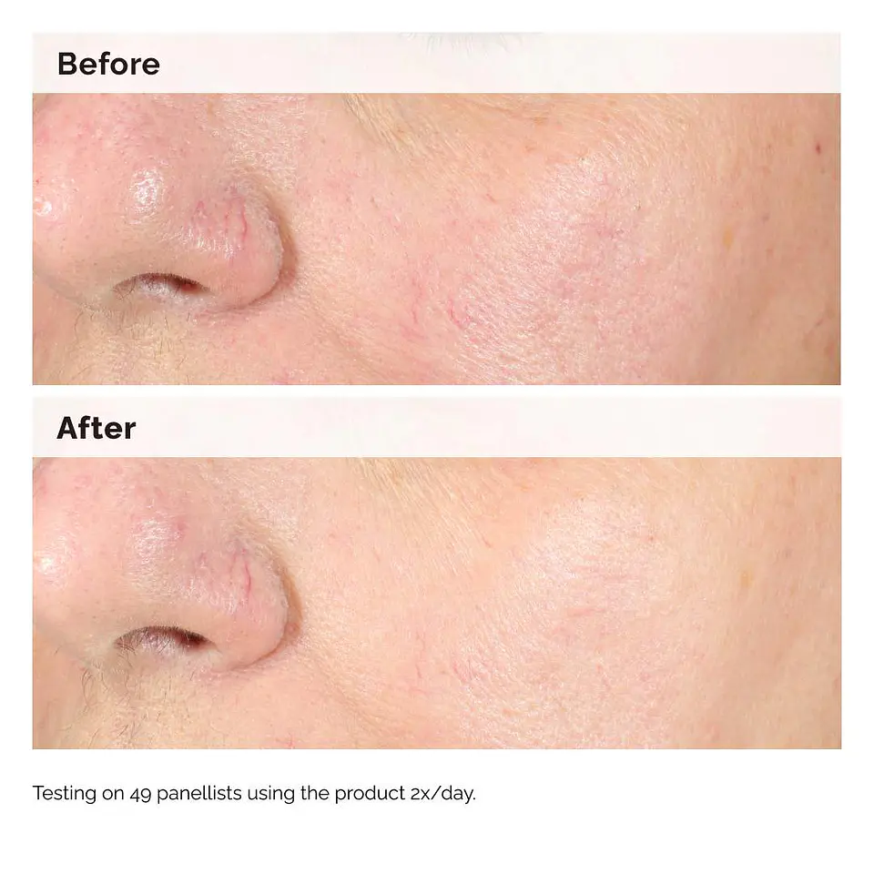 Alpha Arbutin 2% + Hyaluronic Acid for Hyperpigmentation 60ml 3