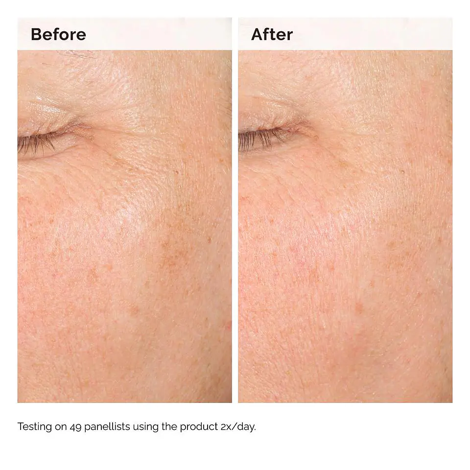 Alpha Arbutin 2% + Hyaluronic Acid for Hyperpigmentation 60ml 4