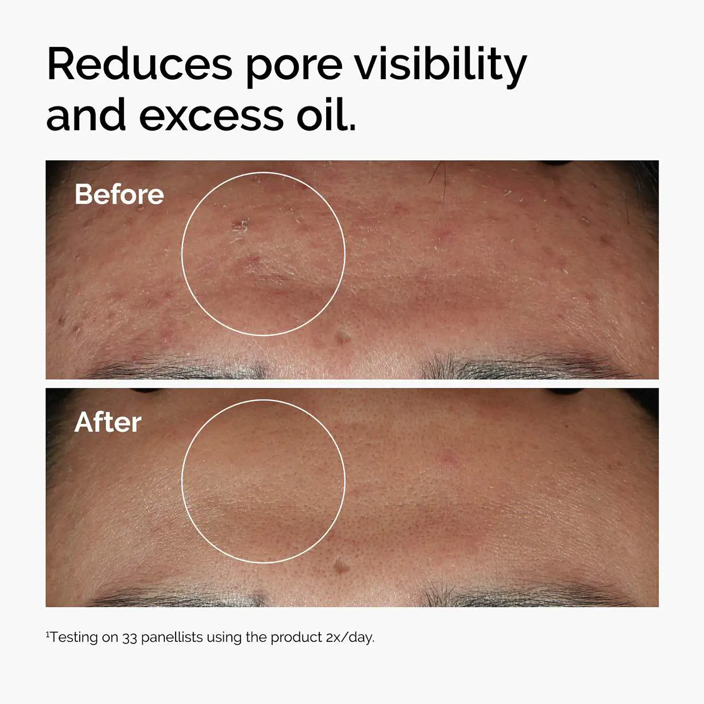 Niacinamide 10% + Zinc 1%  Serum  4