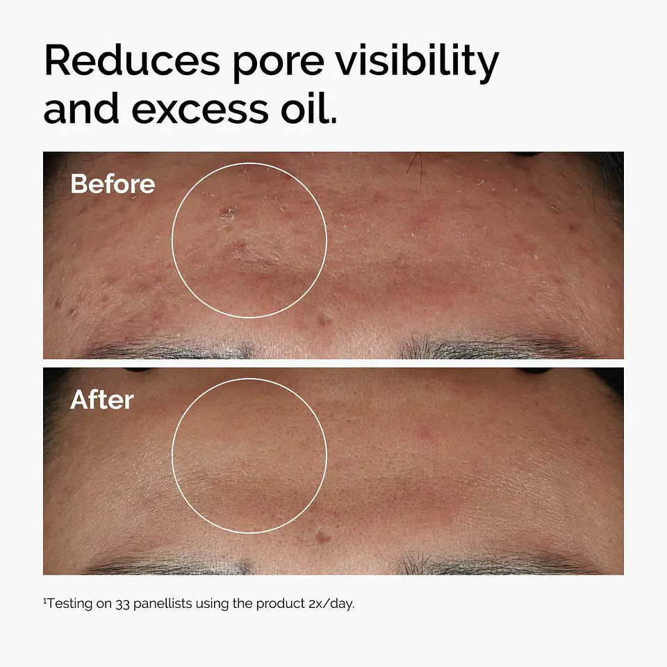 Niacinamide 10% + Zinc 1%  Serum  4