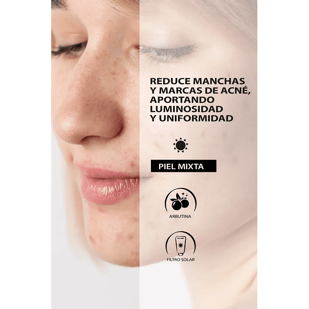 Crema Facial Despigmentante Día 2