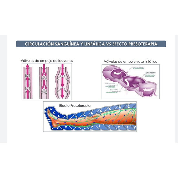 Lipolaser y Presoterapia Pack 6 Sesiones  2