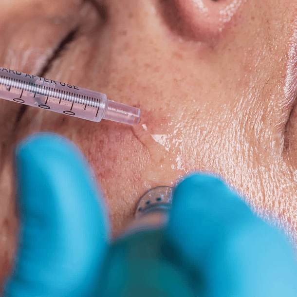 Limpieza Facial Profunda + Pink Glow o Matrigen