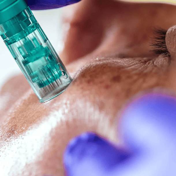 Pack Despigmentante Facial 