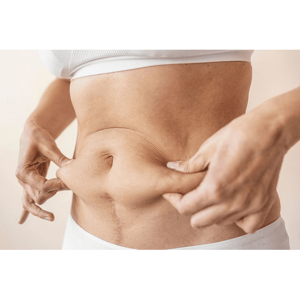 Radiofrecuencia Corporal   1