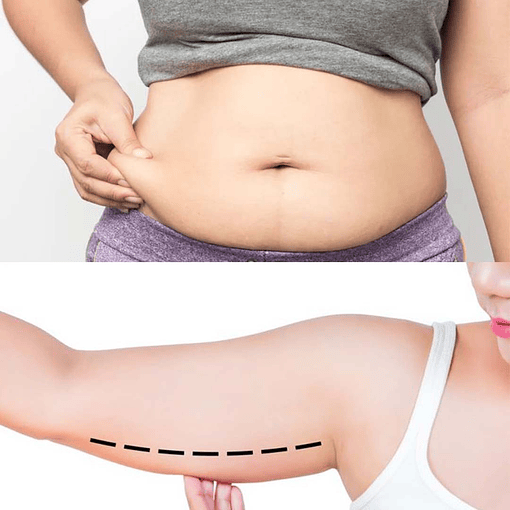 Abdomen & Brazos Reductor y Reafirmante