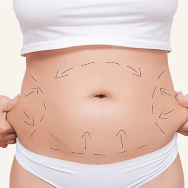 REDUCTOR ENTREPIERNA + ABDOMEN (6 SESIONES) 2