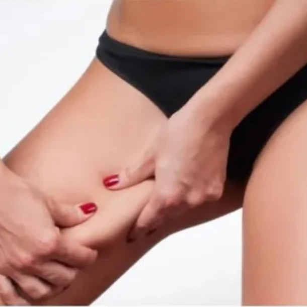 REDUCTOR ABDOMEN + ENTREPIERNA + REAFIRMANTE FACIAL (6 SESIONES) 2