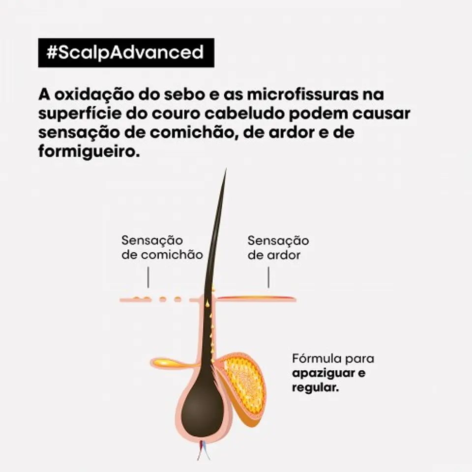 Scalp Advanced - Shampoo Anti-Discomfort 5