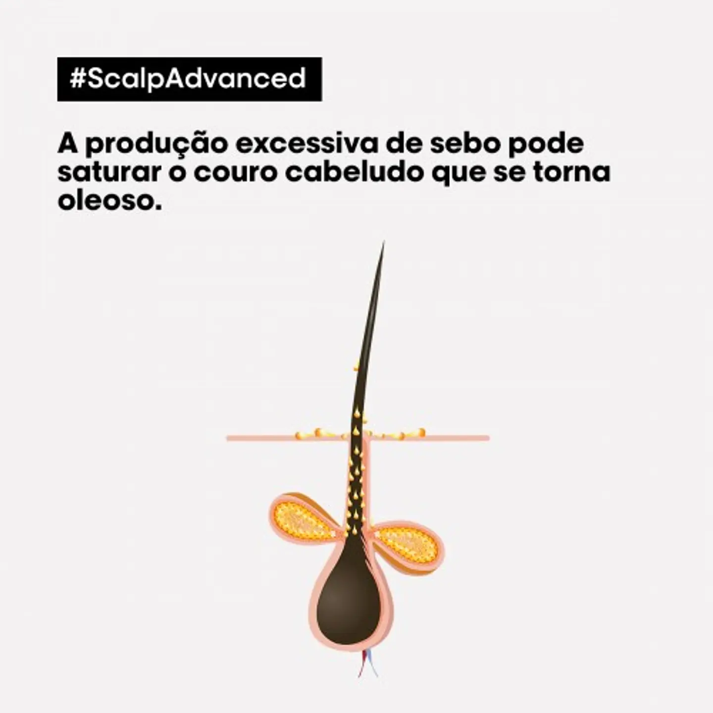 Scalp Advanced - Shampoo Anti-Oiliness  4