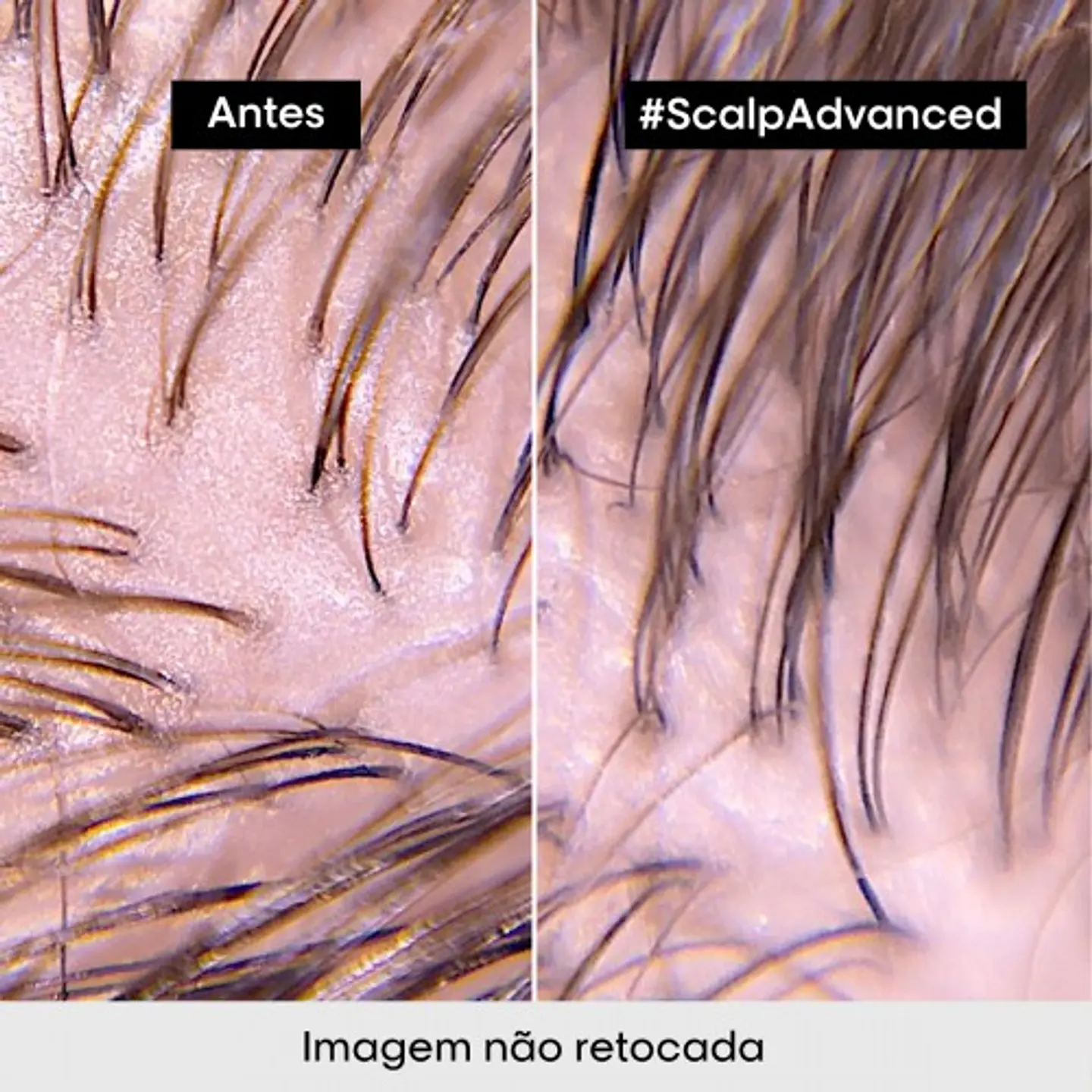 Scalp Advanced - Máscara Anti-Oiliness 2 em 1 4