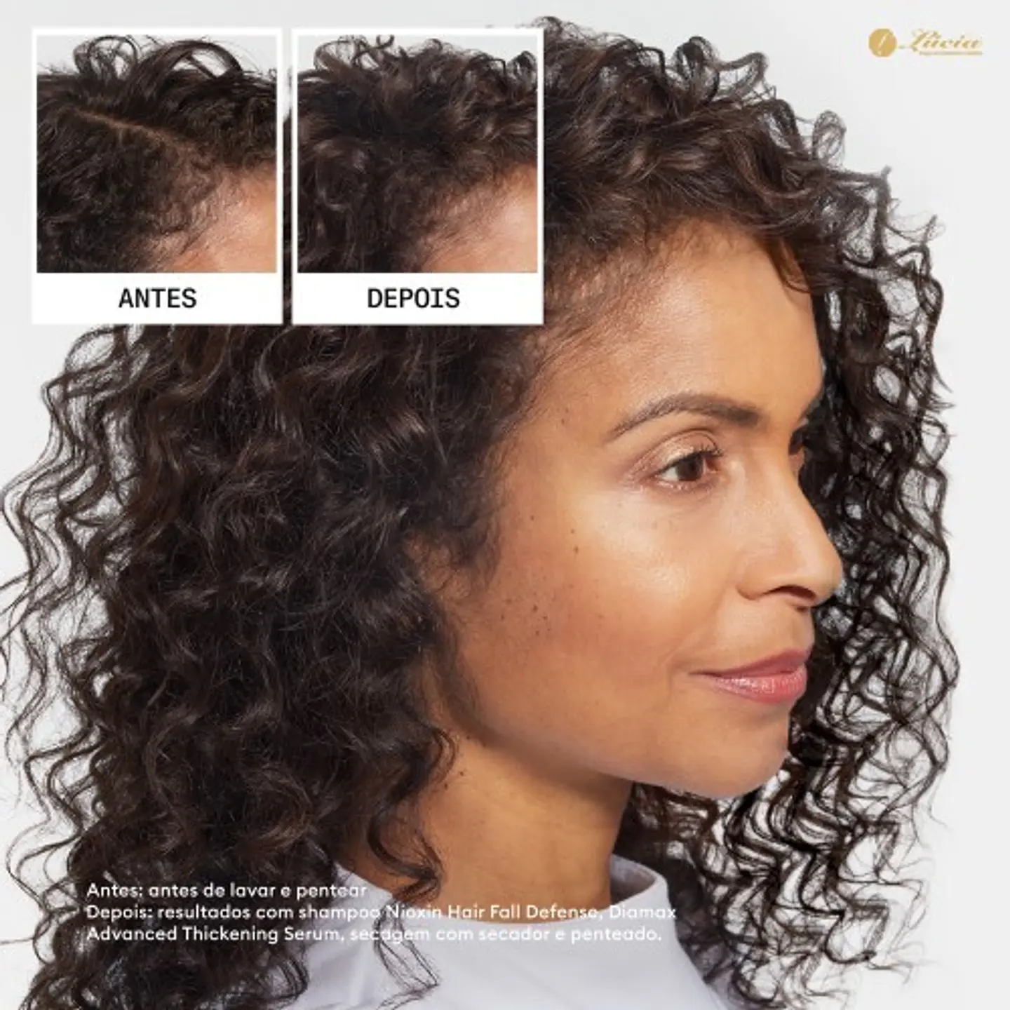 Nioxin - Shampoo Anti-Queda Ultimate Power 240ml 4