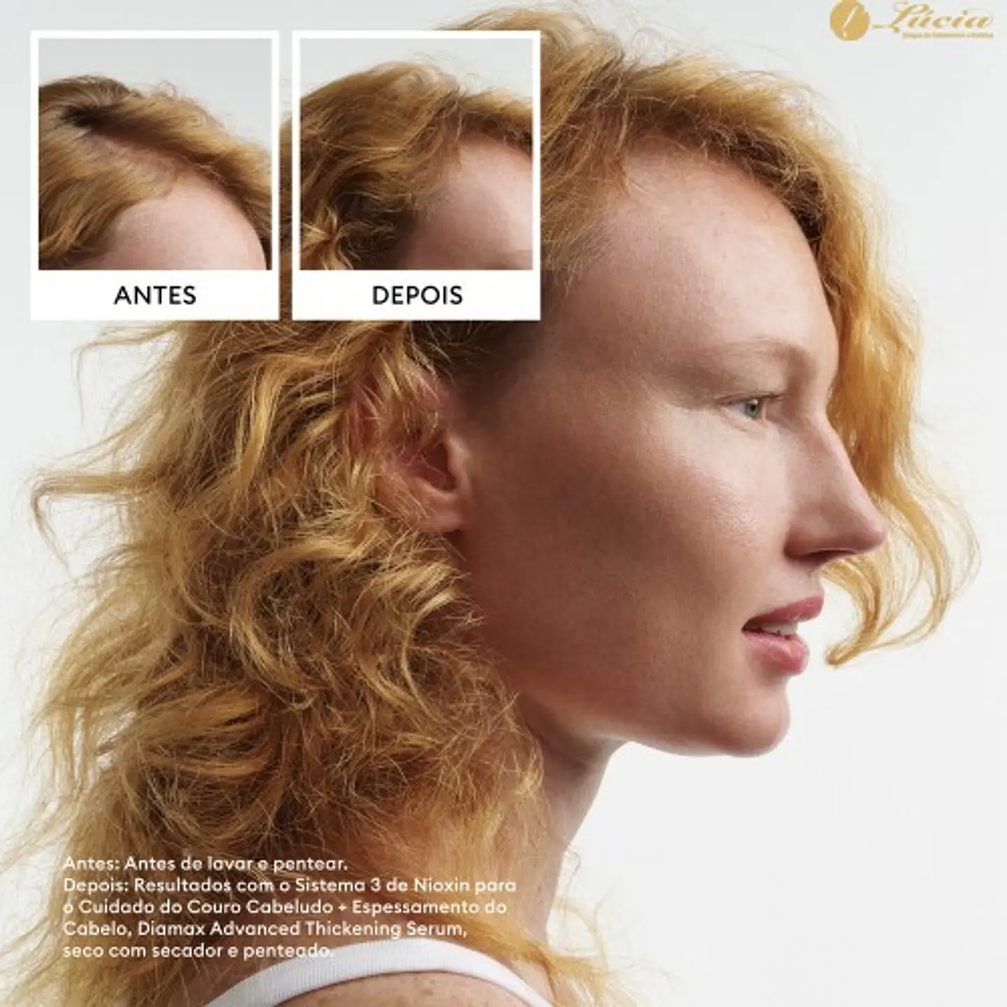 Nioxin - Kit Sistema 4 cabelo com coloração com perda de densidade avançada 5