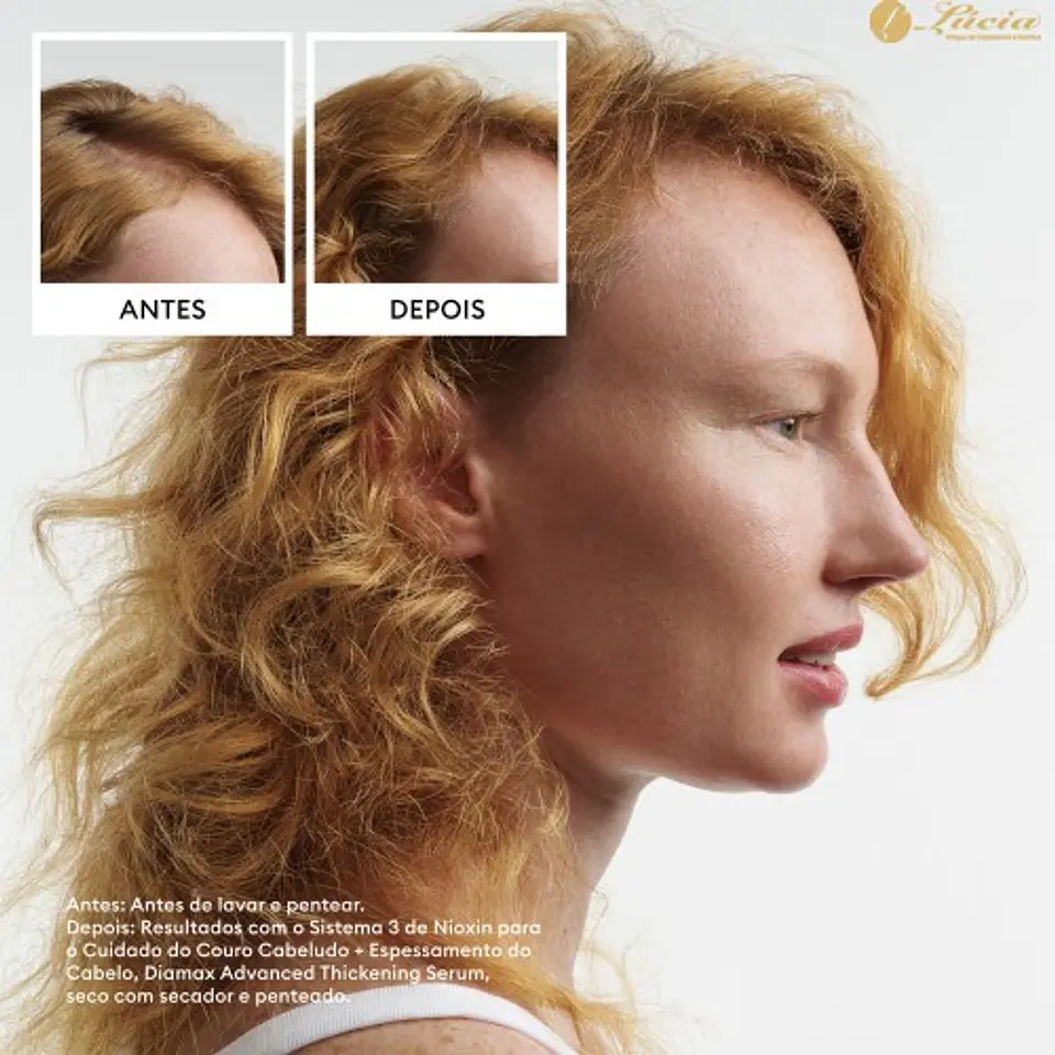 Nioxin - Kit Sistema 4 cabelo com coloração com perda de densidade avançada 5