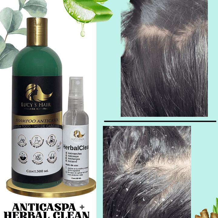 SHAMPOO ANTICASPA,PSORIASIS,SEBORREA,HONGOS X 500  ML 4