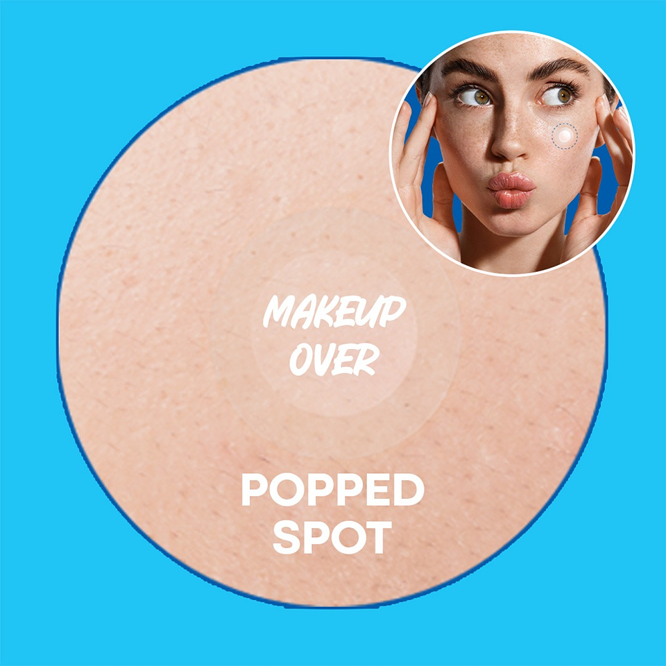 Parches Spot Eraser Blue – Early Stage 4