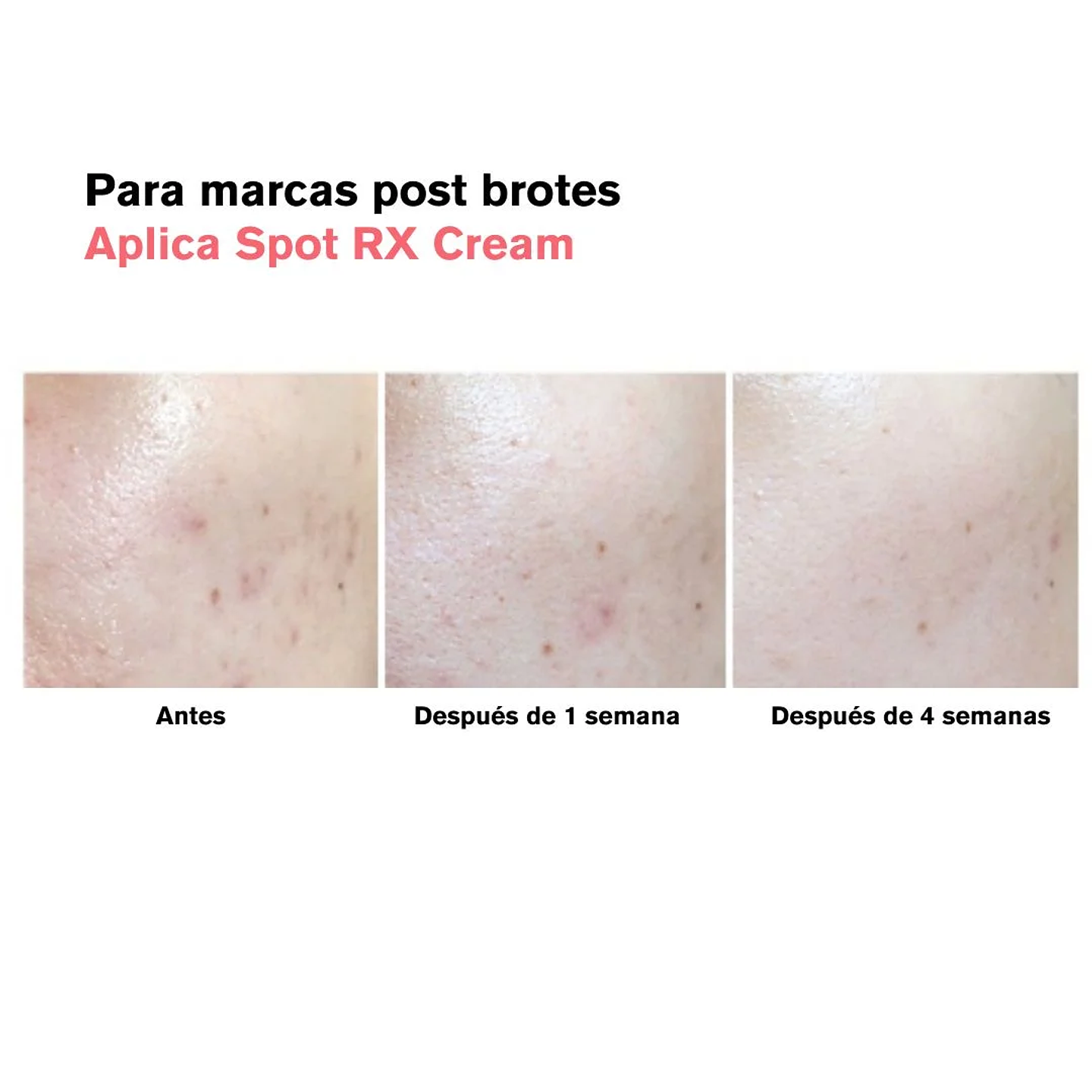 Crema AC Fighting Spot RX Cream 30g 8