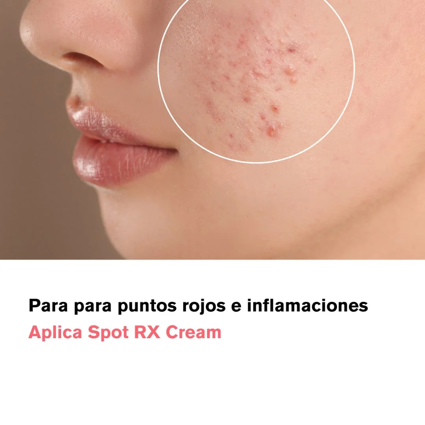 Crema AC Fighting Spot RX Cream 30g 9