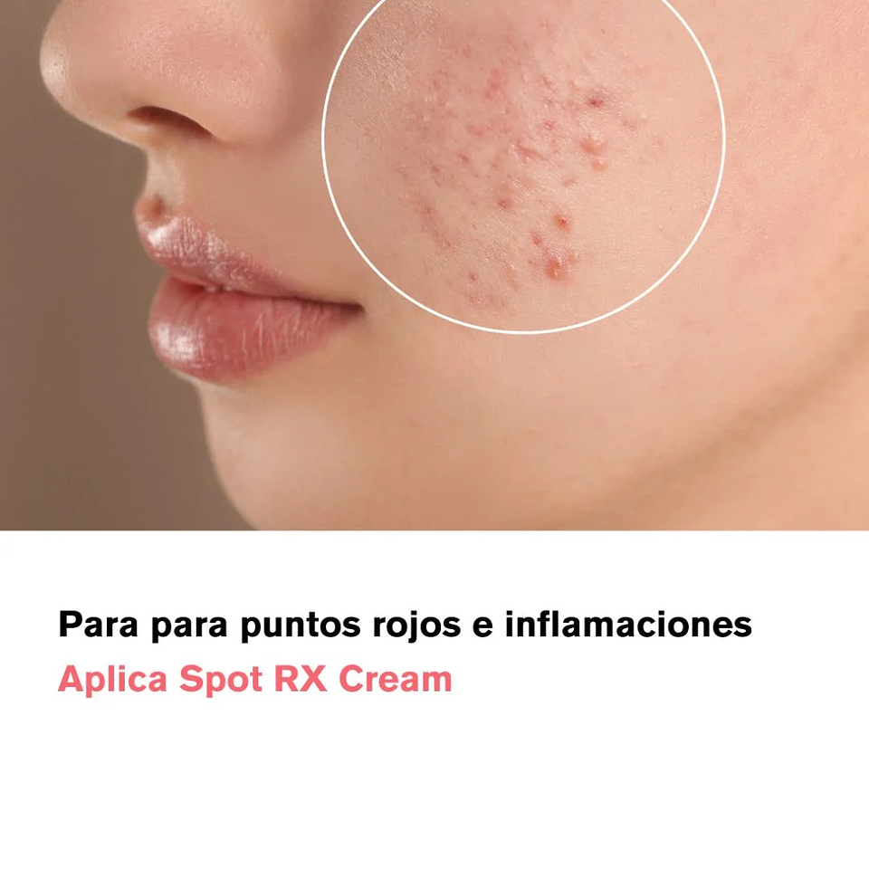 Crema AC Fighting Spot RX Cream 30g 9