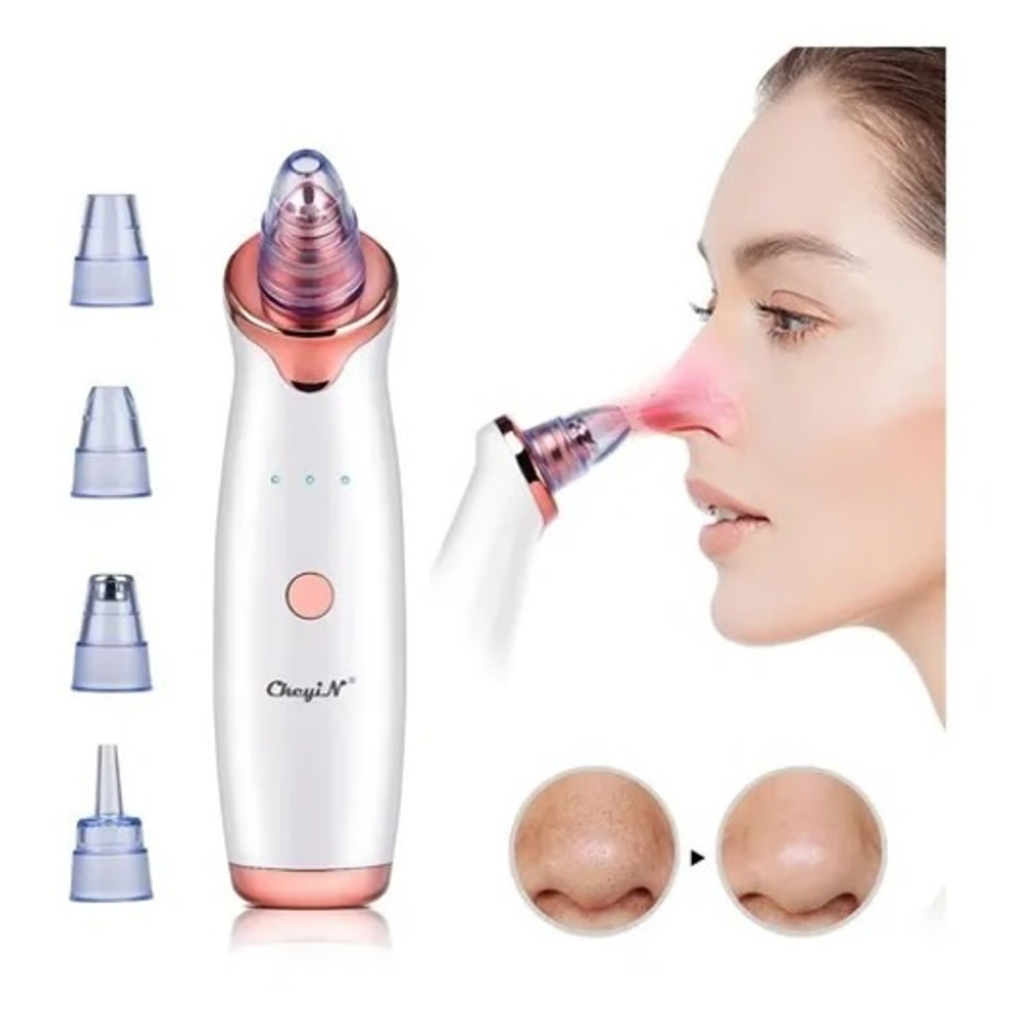 Removedor Multifuncional De Espinillas Puntos Negros Limpiador Facial 3