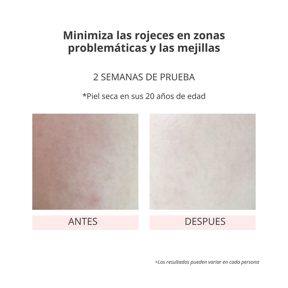 Serum Vegan Green Mild Intense Serum Toner 110ml 11