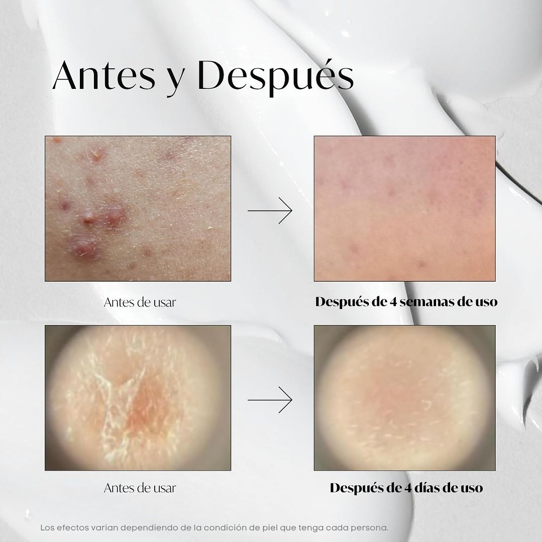 Reedle Shot 100 Stick Pouch 10ea 6