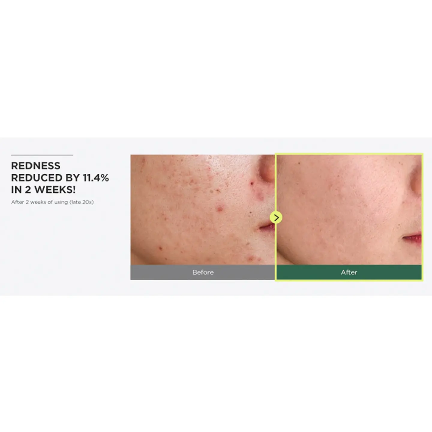 Heartleaf 77% Soothing Toner 250ml 5