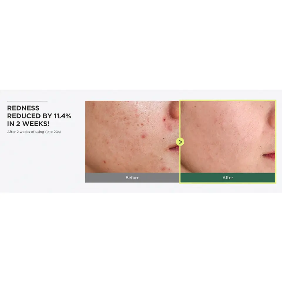 Heartleaf 77% Soothing Toner 250ml 5