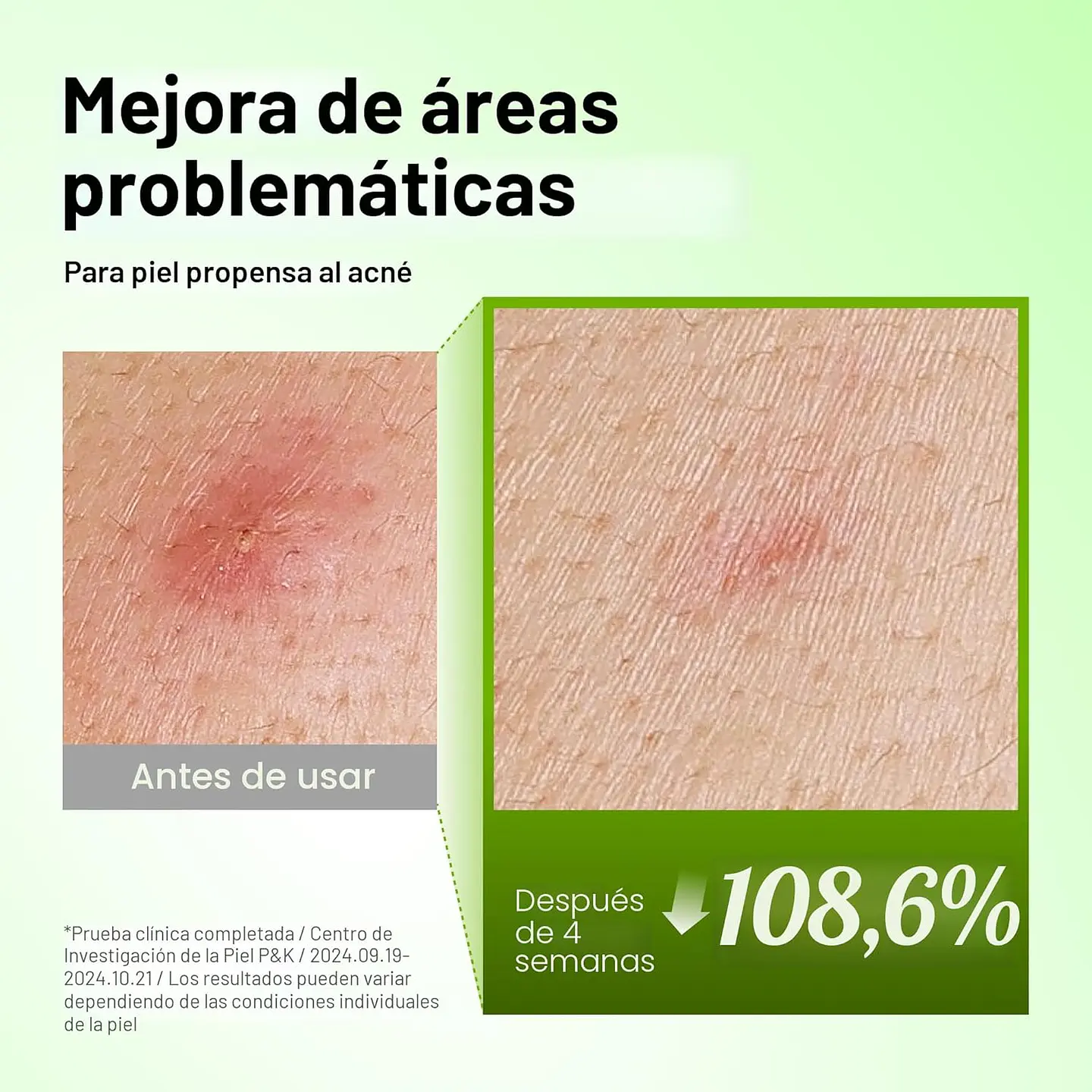 Serum Azelaic 10 Hyaluon Soothing 30ml 7