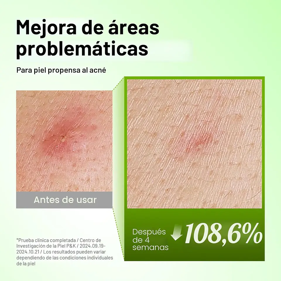 Serum Azelaic 10 Hyaluon Soothing 30ml 7