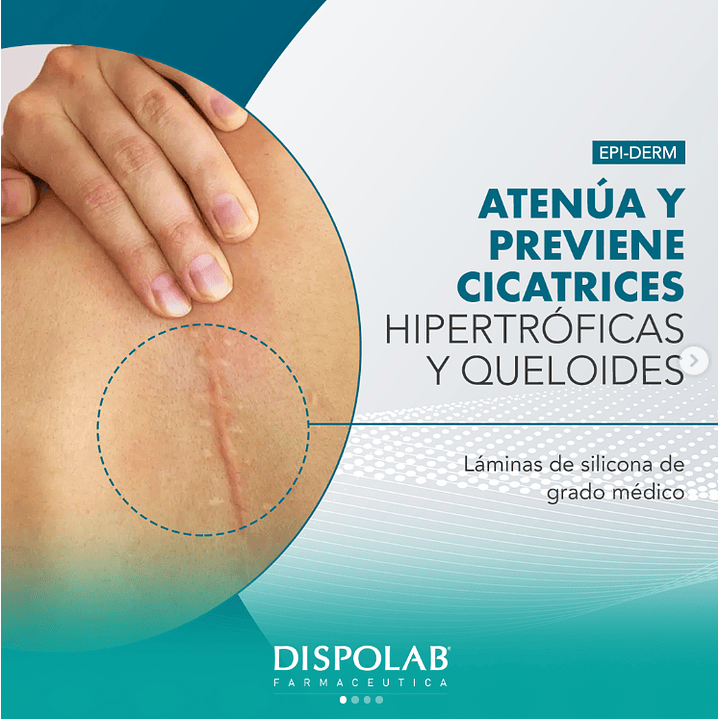 Epiderm Lamina Silicona Para Cicatrices Egd-1000 14.5x3.5cm Pack x2 5