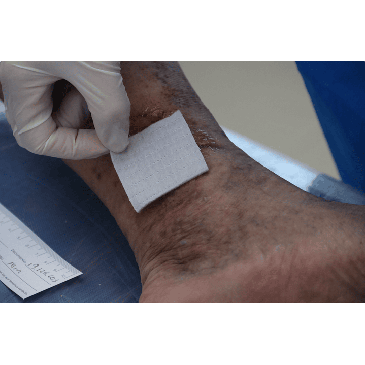 Aposito Aquacel Extra 5cmx5cm Convatec Pack x5 3