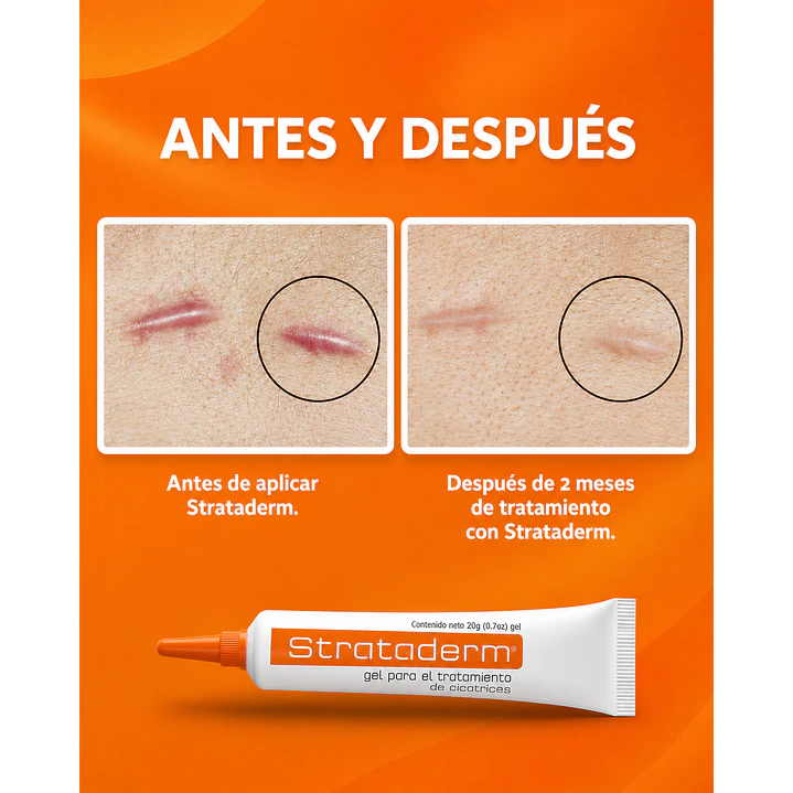 Strataderm Gel Tratamiento Profesional De Cicatrices 5g 8